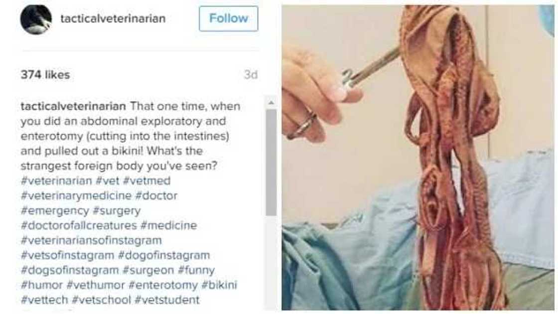 Likita ya fitar da wani abun mamaki a cikin tumbin wani (Hotuna) Likita ya fitar da wani abun mamaki a cikin tumbin wani (Hotuna)