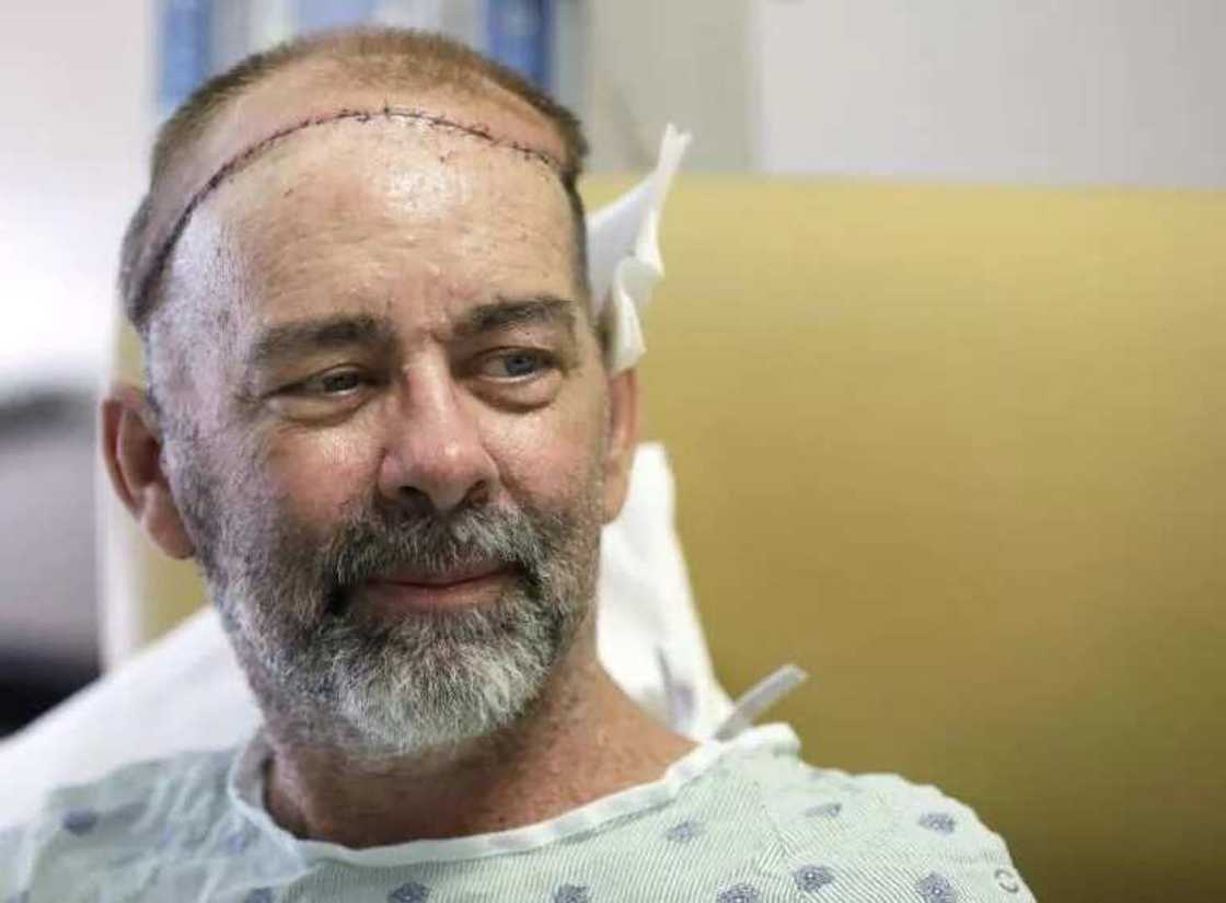 Doctors Perform World's First Skull-Scalp Transplant