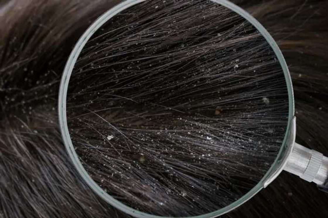 Yadda zaku yi maganin amosanin ka Yadda zaku yi maganin amosanin ka