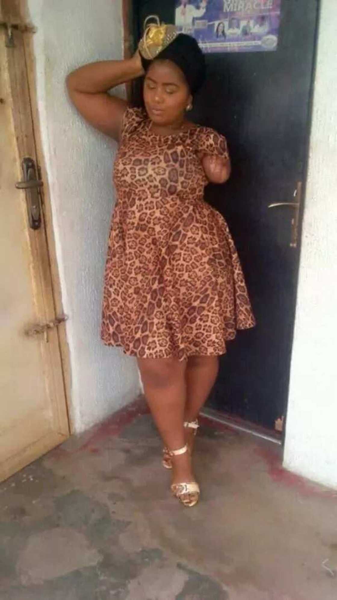 Nigerian lady who lost her hand in accident reveals why she won't stop smiling