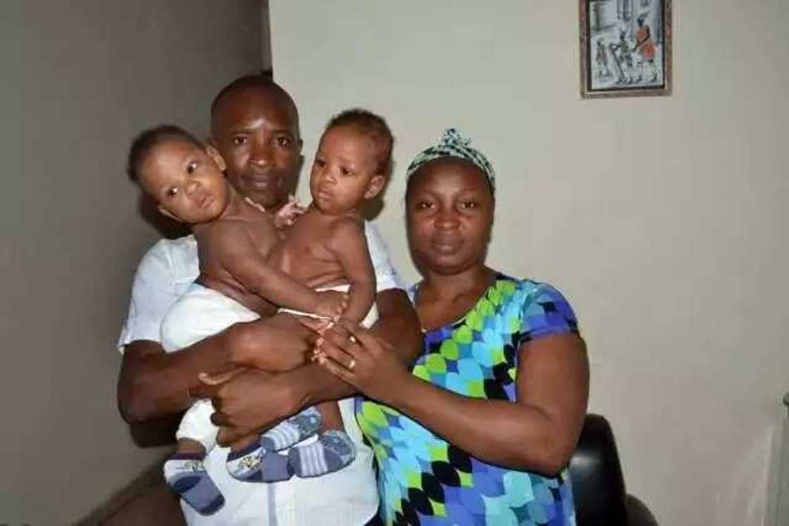 Nigerian conjoined twins separated by 22 doctors in India (photo) Nigerian conjoined twins separated by 22 doctors in India (photo)