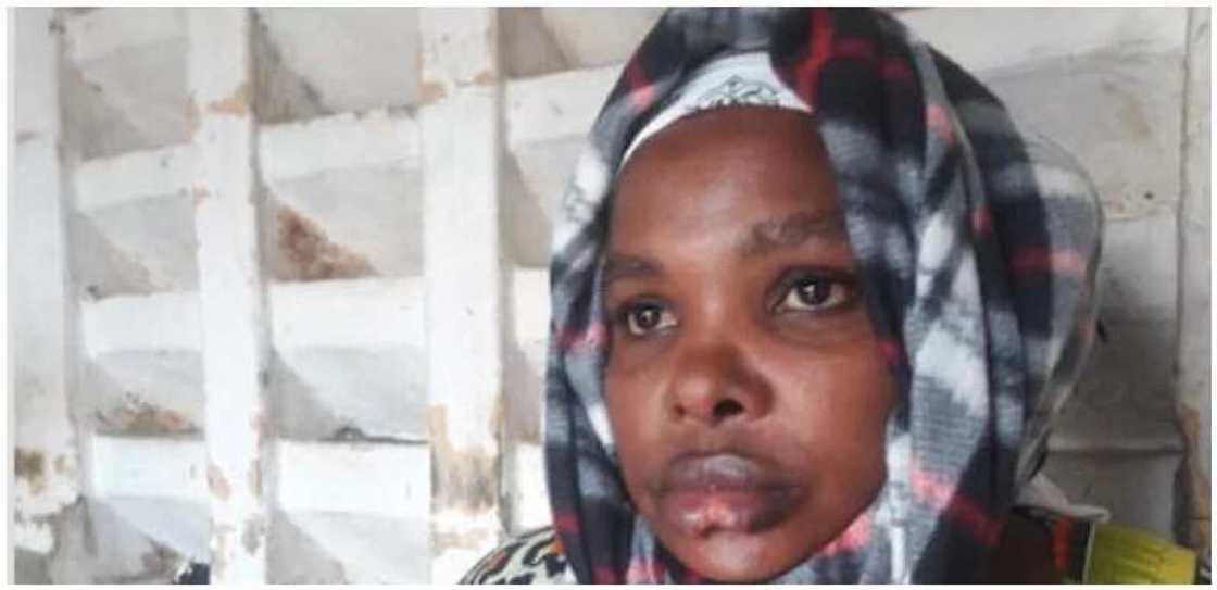 Lalacewa: Miji ya cizge leben matar sa yayin da suke dakuwa Lalacewa: Miji ya cizge leben matar sa yayin da suke dakuwa