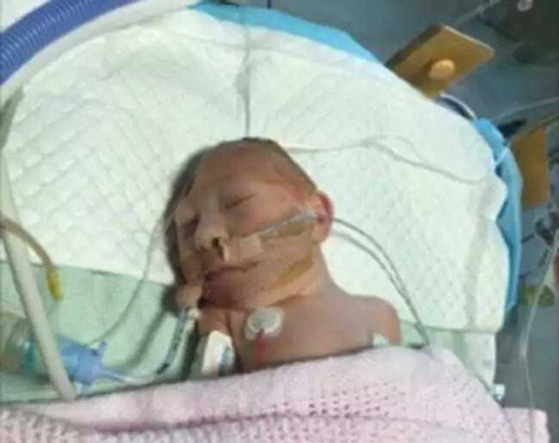 Jaririyar da aka haifa da kwakwalwarta a waje ta rayu Jaririyar da aka haifa da kwakwalwarta a waje ta rayu