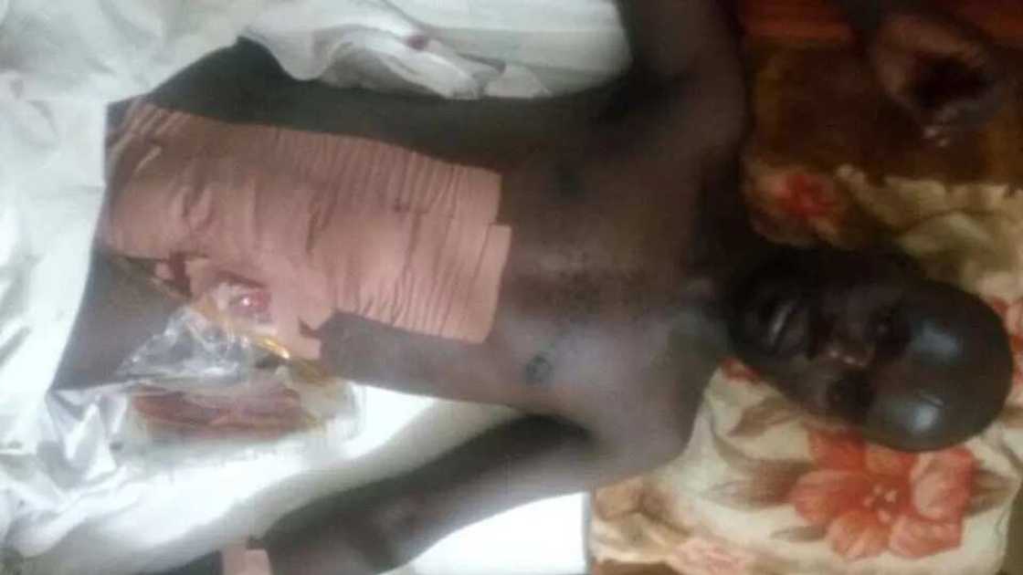 Boko Haram: JTF member injured in battle with insurgents (photos) Boko Haram: JTF member injured in battle with insurgents (photos)