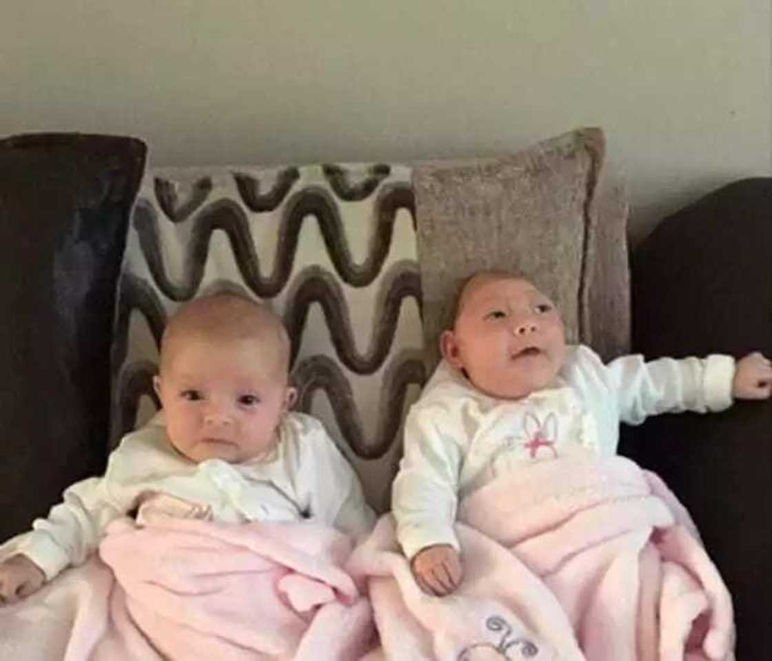 Jaririyar da aka haifa da kwakwalwarta a waje ta rayu Jaririyar da aka haifa da kwakwalwarta a waje ta rayu