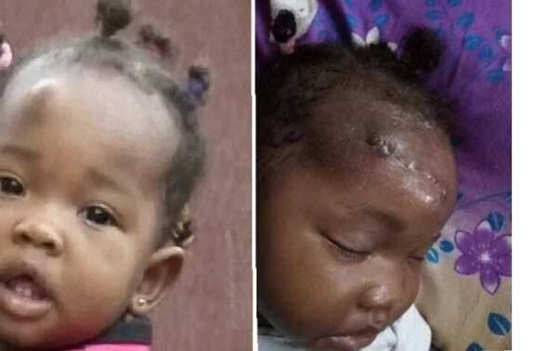 Nigerian mother cries out after surgery leaves her daughter with large facial scars (Photos)