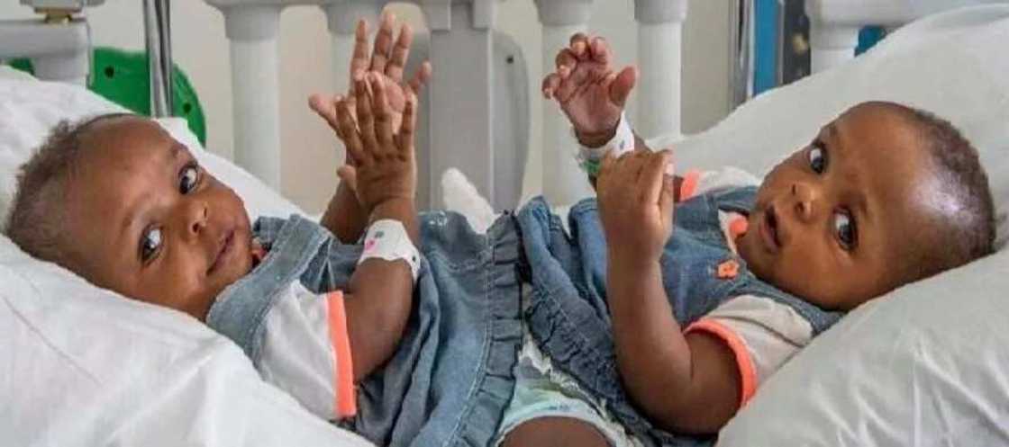 Wasu zakakuran likitoci a jihar Adamawa sun raba wasu jarirai 2 da suka zo Duniya a hade Wasu zakakuran likitoci a jihar Adamawa sun raba wasu jarirai 2 da suka zo Duniya a hade