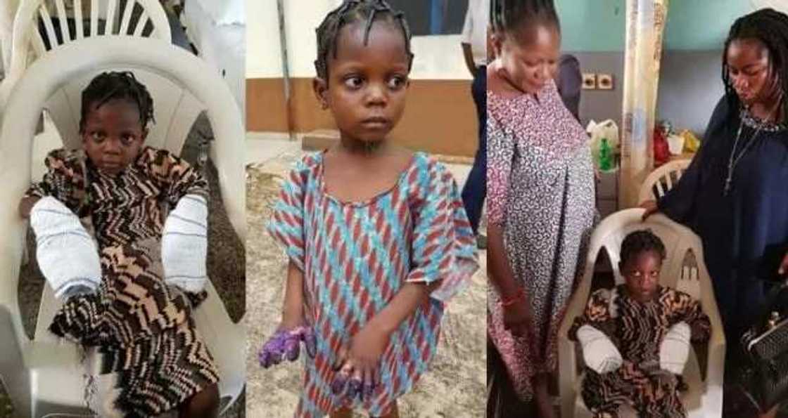 Anyiwa yarinyar da kakarta ta kona ta a jihar Edo aiki Anyiwa yarinyar da kakarta ta kona ta a jihar Edo aiki