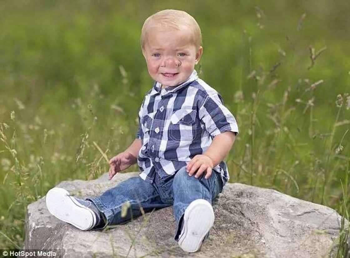 Baby Dubbed Pinocchio After Being Born With Brain In His Nose Baby Dubbed Pinocchio After Being Born With Brain In His Nose