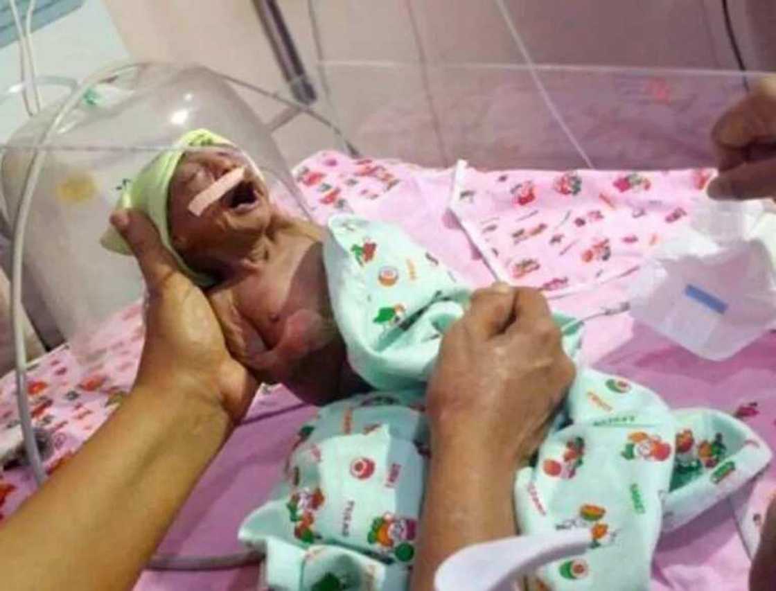 Newborn Baby Abandoned By Parents Due To Wrinkly Skin