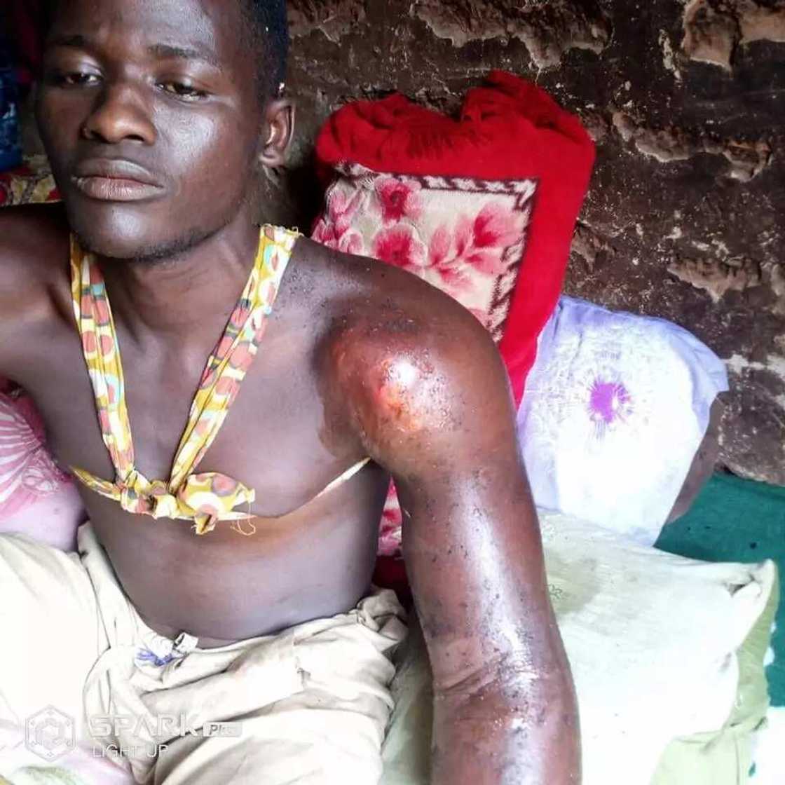 Hannun wani matashi da ‘yan sanda suka yiwa dukan tsiya ya fara rubewa, kalli hotuna Hannun wani matashi da ‘yan sanda suka yiwa dukan tsiya ya fara rubewa, kalli hotuna