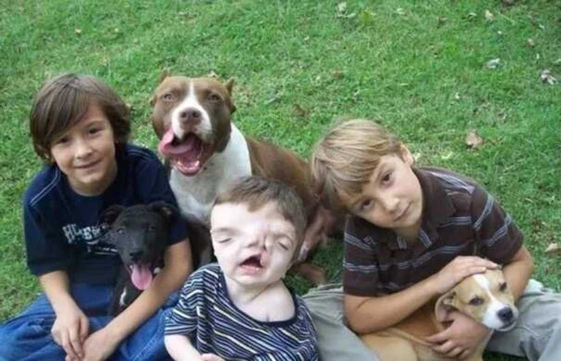 Zul waja haini: Yaro mai fuska 2 ya cika shekaru 13 (Hotuna) Zul waja haini: Yaro mai fuska 2 ya cika shekaru 13 (Hotuna)