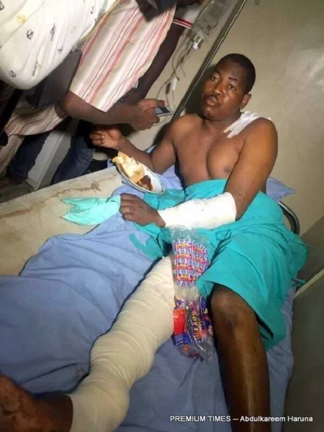 IDP camp bombing survivor IDP camp bombing survivor