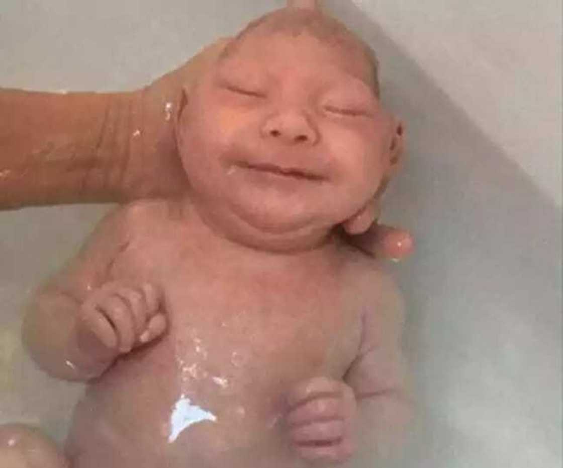 Jaririyar da aka haifa da kwakwalwarta a waje ta rayu Jaririyar da aka haifa da kwakwalwarta a waje ta rayu