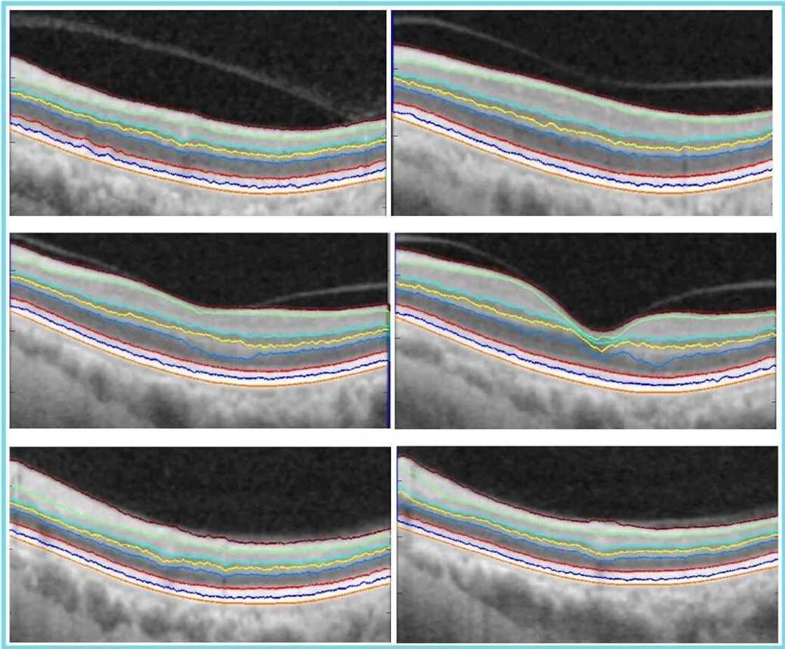 Bashir Dodo yayi binciken da zai taimaki marasa lafiyar idanu Bashir Dodo yayi binciken da zai taimaki marasa lafiyar idanu