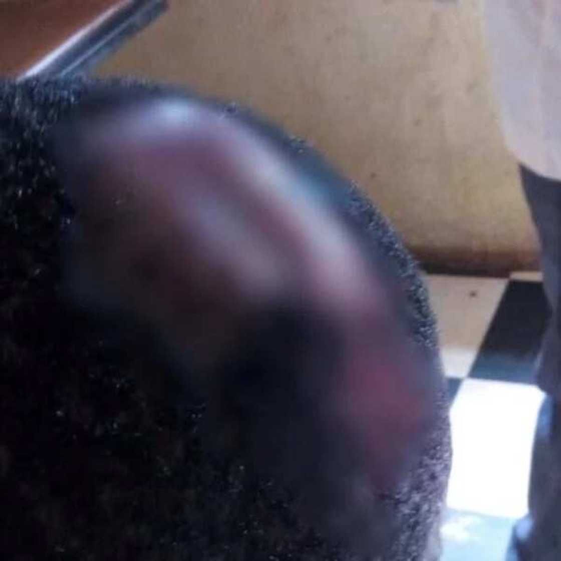 Masquerades allegedly break head of a Catholic seminarian in Enugu (photo) Masquerades allegedly break head of a Catholic seminarian in Enugu (photo)