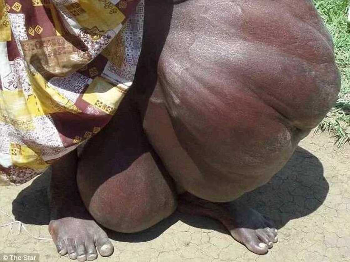 Yan kauye sunyi watsi da wata mata mai ciwon kafa Yan kauye sunyi watsi da wata mata mai ciwon kafa