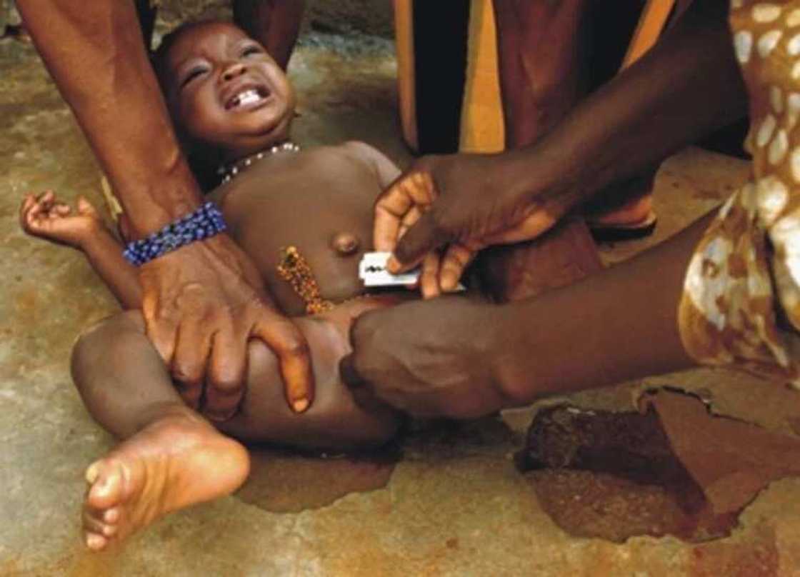 20 Male circumcision 20 Male circumcision
