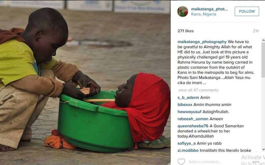 How Journalist Help Girl With Half-Body Survive How Journalist Help Girl With Half-Body Survive