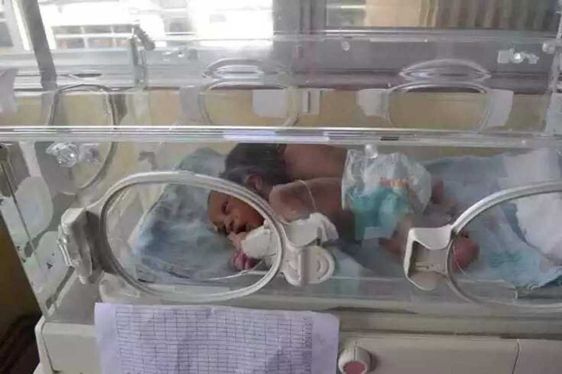 Abun mamaki, yan biyun da aka haifesu a kenya an raba su Abun mamaki, yan biyun da aka haifesu a kenya an raba su