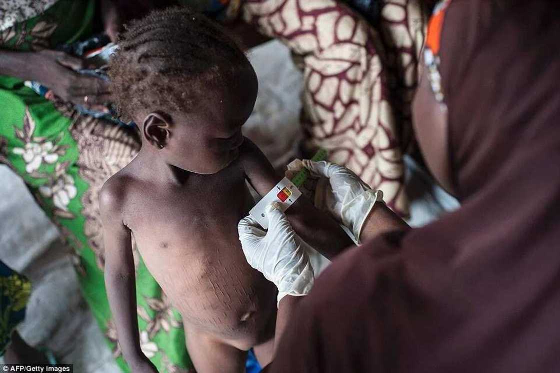 Malnutrition crisis hits IDP camps in Borno Malnutrition crisis hits IDP camps in Borno