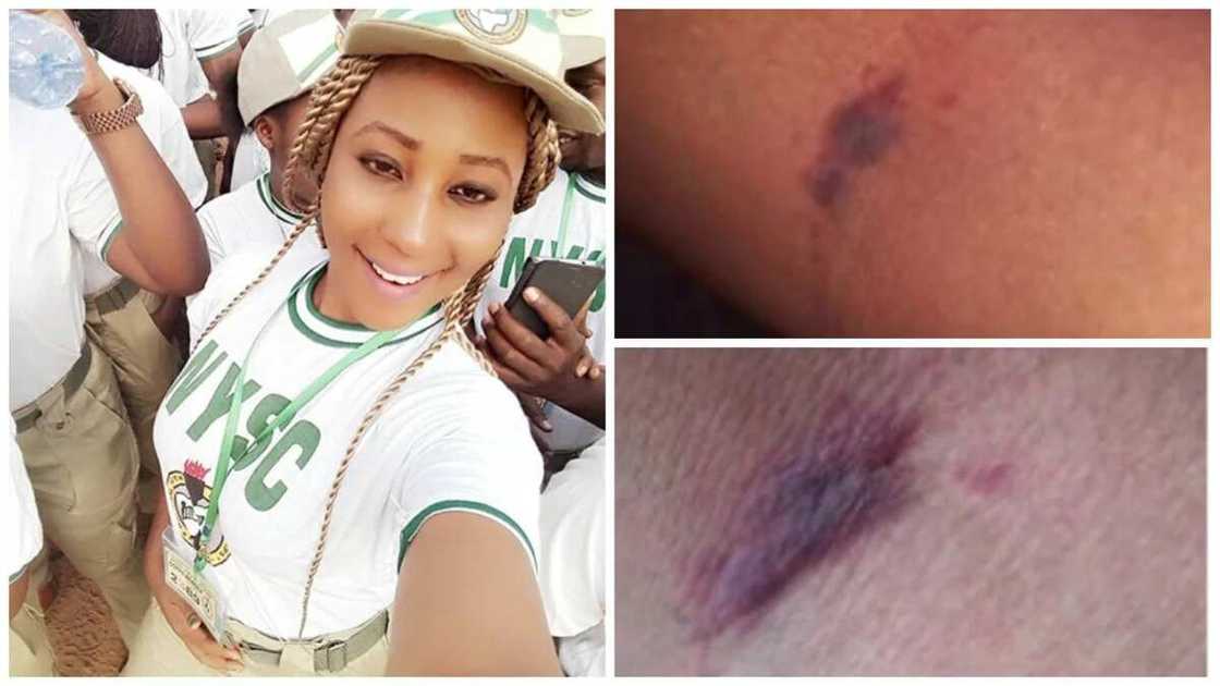 How an NYSC official brutalized me for not wearing my jacket – Female corp member cries out (photos)