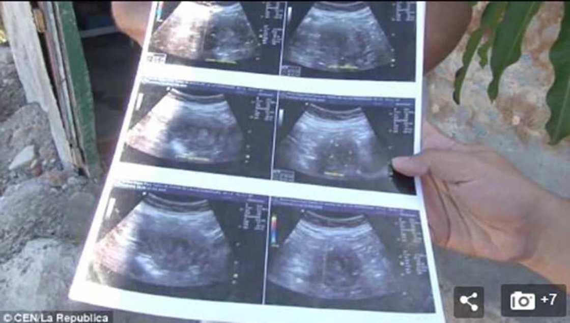 Allah buwayi gagara misali: Kunga tsohuwa mai shekara 70 dauke da ciki wata 6 Allah buwayi gagara misali: Kunga tsohuwa mai shekara 70 dauke da ciki wata 6