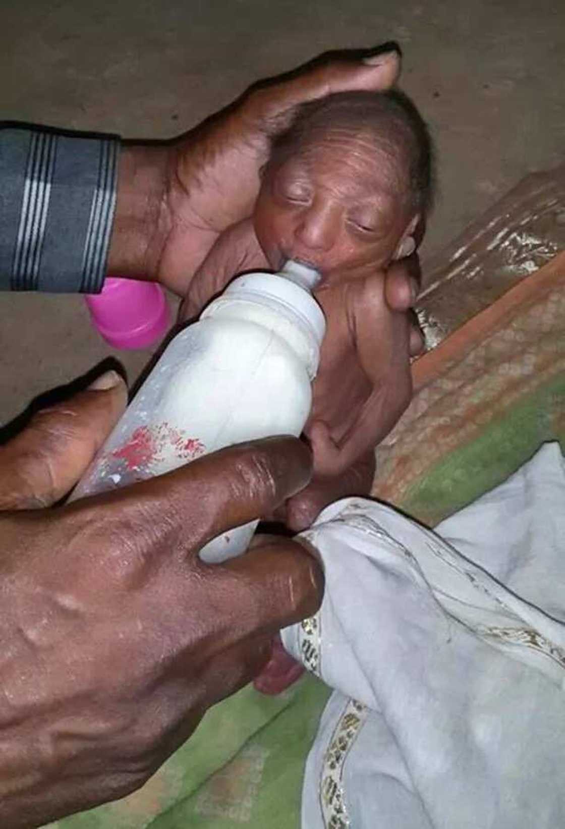 Newborn Baby Abandoned By Parents Due To Wrinkly Skin