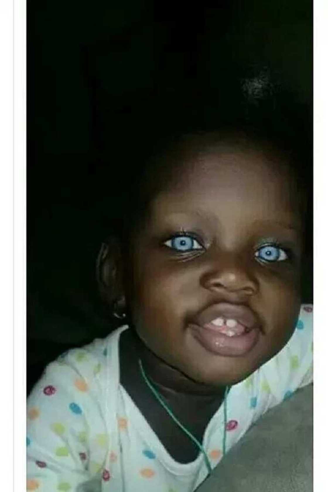 Ana zargin karamar yarinya da maita bisa launin idanun ta Ana zargin karamar yarinya da maita bisa launin idanun ta