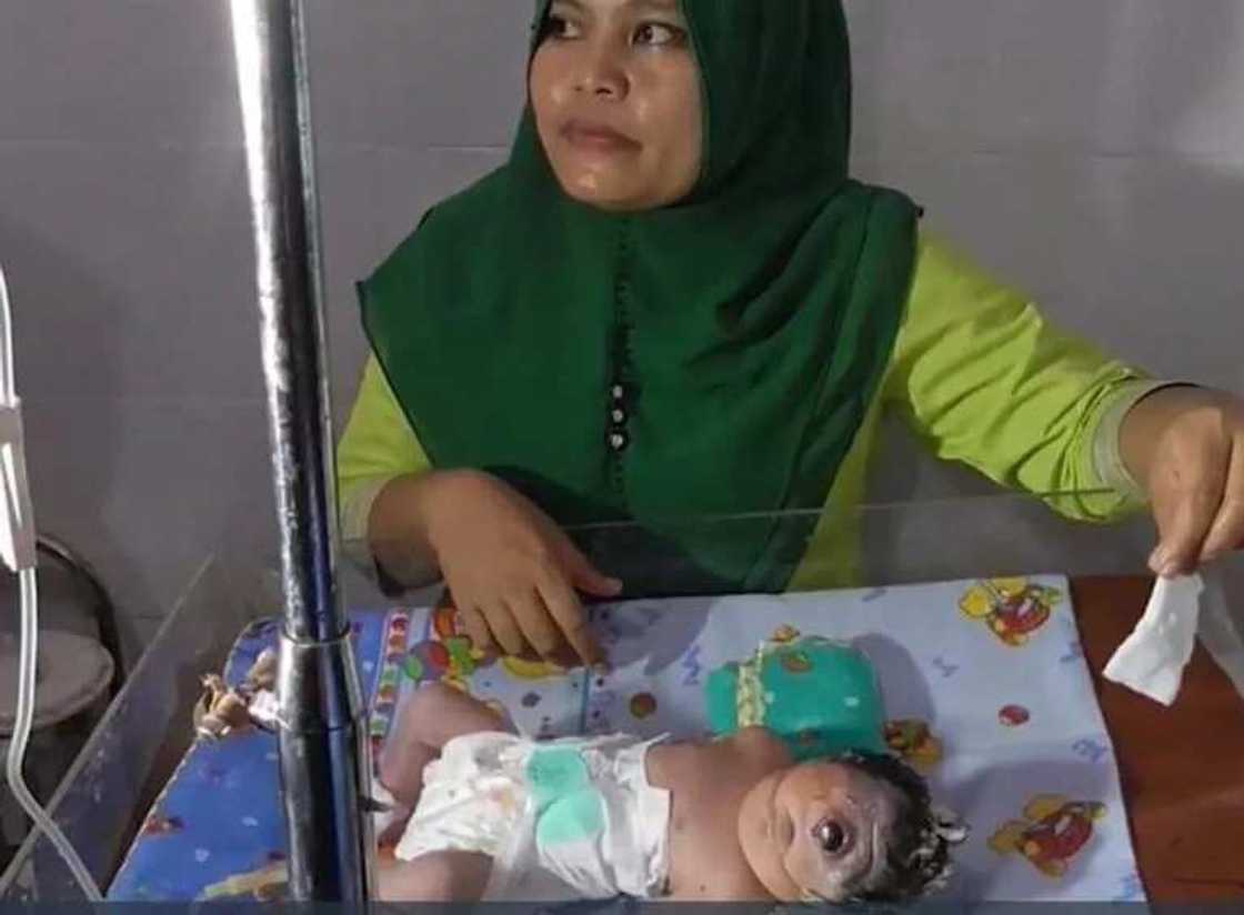 Ikon Allah: wata mata ta haifi jariri da ido daya a tsakiyar goshi, hotuna Ikon Allah: wata mata ta haifi jariri da ido daya a tsakiyar goshi, hotuna