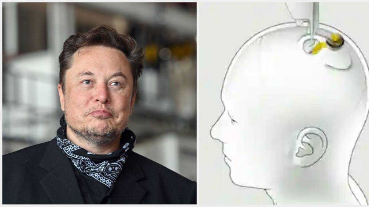 Elon Musk's Neuralink Gets Govt Approval to Implant Microchips in Human ...