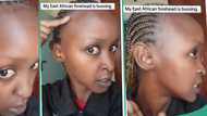 "Even a wig cannot fit": Lady shows her unique forehead with no hair, video goes viral