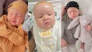 "Doctor told me he won't be an albino": Mum posts video of son with albinism, netizens gush over his cuteness
