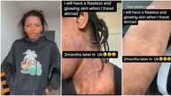 "Looking rough": Nigerian lady cries out as her skin goes terrible 2 months after moving to UK, shares video
