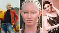 I laugh when people say albinos don't take salt: Pretty Nigerian albino, 24, shares secret to her fine skin