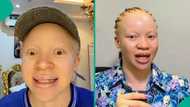 "Can albino see from afar?" Lady answers viral question, shares her personal experience