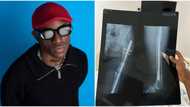 “I just went through my 3rd surgery”: Singer Victony announces 2 months break, tells fans to pray for him