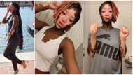 "You're really pretty": Lady with big patches of unique skin colour on her face & arms trends, video emerges