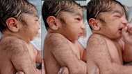 "Hairy from the first day": New born baby with so much hair on its body and face goes viral
