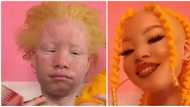 Albino fashionista transforms look with sleek makeup and stylish hairdo in viral video