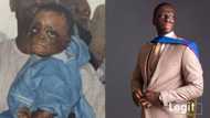 Nigerian bags good degree after surviving 17 surgeries and fire that burnt him when he was 14 months old