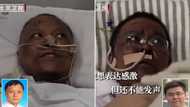 Launin fatar wasu likitoci biyu a China ya sauya bayan sun warke daga cutar covid-19 (Hoto)