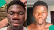 Nigerian man spends N18 million on nose job, flaunts his new look in video