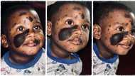"He looks very unique": Handsome boy with black marks on his face trends online as cute photos emerge