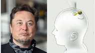 Elon Musk's Neuralink gets govt approval to implant microchips in human brains, releases video