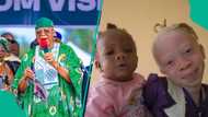 How I was mocked for my albinism during campaigns, Akwa-Ibom gov narrates ordeal