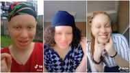 "I was not allowed to go out": Albino lady with perfect skin reveals how she became beautiful