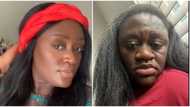 "My nose swelled up": Lady posts unbelievable changes her body went through During pregnancy, video goes viral