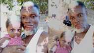 "She is your photocopy": Man with white patches on his body gives birth to baby with same marks, video emerges