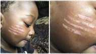 "The mark will go": Daycare teacher gives school child 4 long "tribal marks" on face, mother posts photo